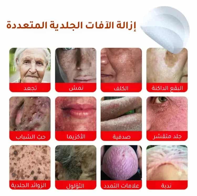 صورة 2